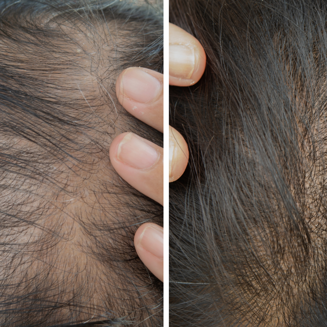 Thicker, Healthier Hair